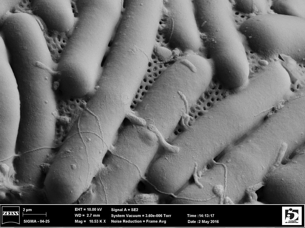 Detail of a Lesquereusia spiralis shell, showing the pattern of construction using endogenously produced sausage-shaped silica particles, pieced together with a porous cement. Anush Kosakyan